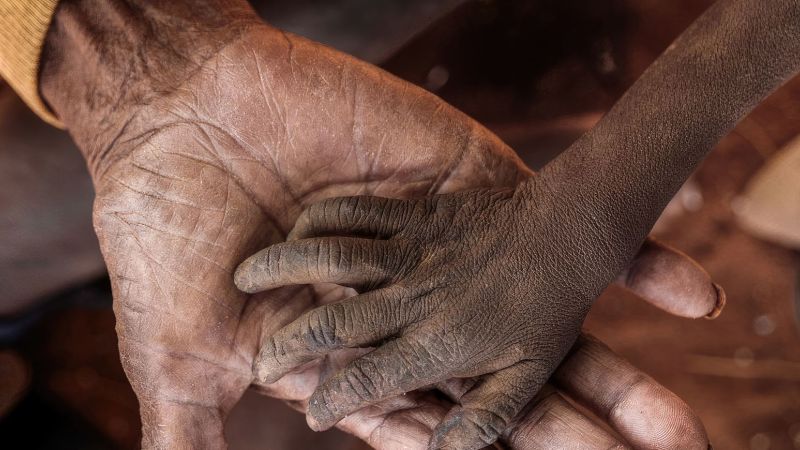 A Madagascar, l’UNICEF a traité en deux mois autant d’enfants pour malnutrition aiguë sévère qu’en un an normalement. ENTRETIEN